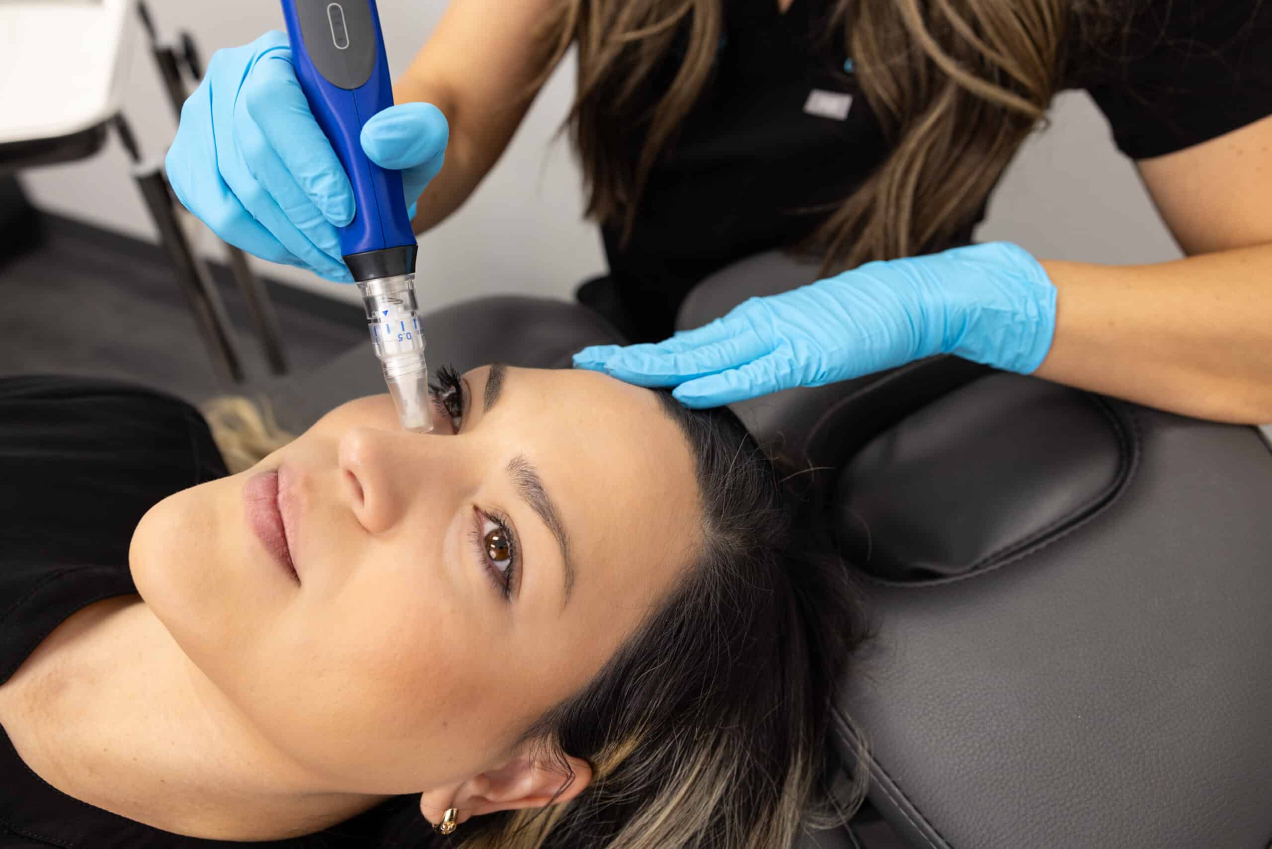 A person with long hair is lying on a chair receiving a microneedling treatment on their forehead. The practitioner, wearing blue gloves, is holding a blue microneedling device and gently applying it to the client's forehead. The client appears relaxed with their eyes closed.
