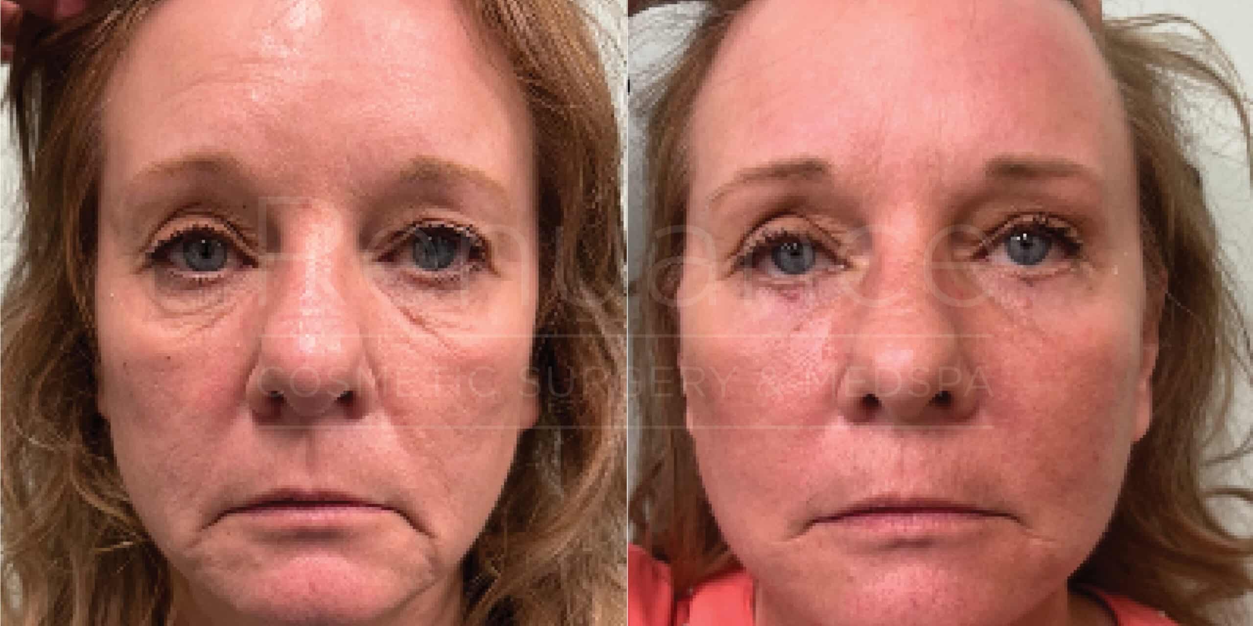 Renuance Dr Cohen Face and Eyes