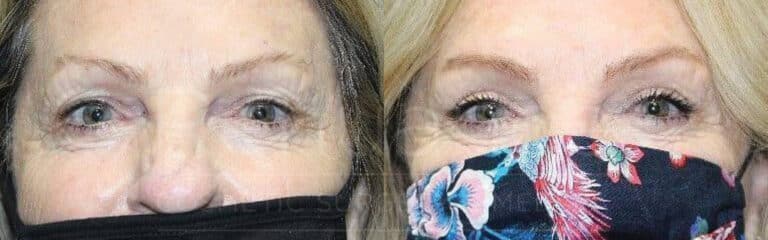 Two side-by-side photos of a woman wearing face masks. In the photo on the left, the woman is wearing a black face mask and has grayish hair. In the photo on the right, the same woman is wearing a floral-patterned face mask with colors like blue, pink, and red. She appears to have similar grayish hair.