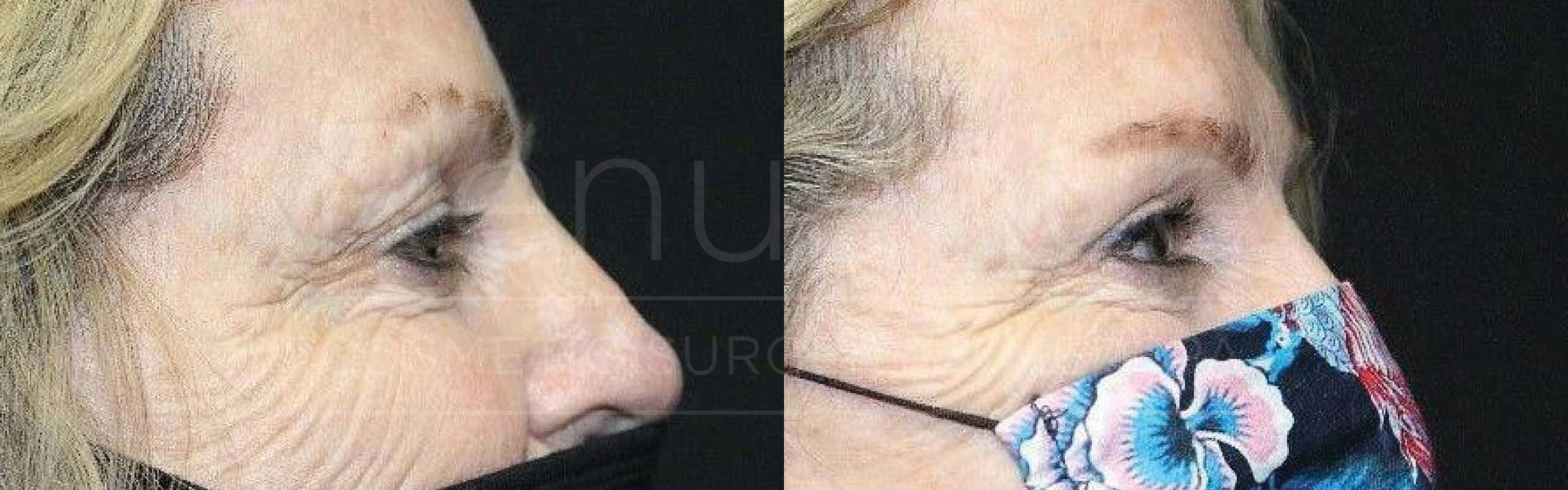 Two side-by-side photos of a woman wearing face masks. In the photo on the left, the woman is wearing a black face mask and has grayish hair. In the photo on the right, the same woman is wearing a floral-patterned face mask with colors like blue, pink, and red. She appears to have similar grayish hair.