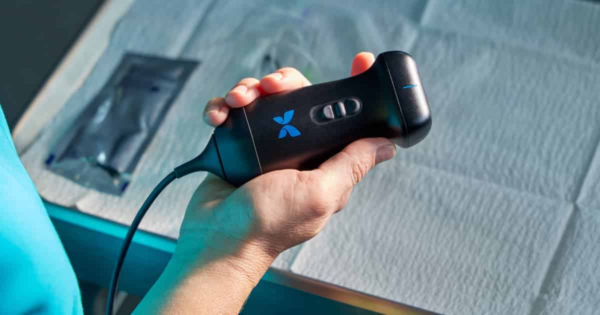 Doctor's Hand Holding Breast Imaging Device at Renuance Murrieta