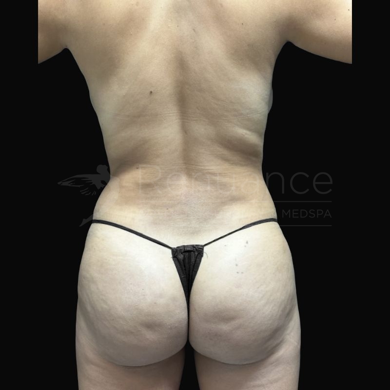 Case--8231H | After Michael E. Hill, MD