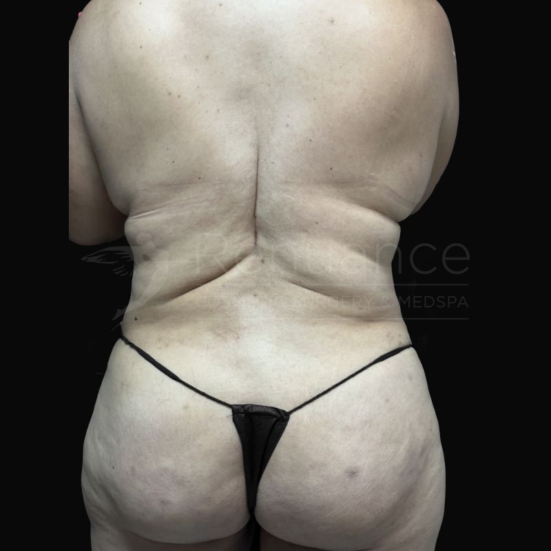 Case--9149H | Before Michael E. Hill, MD