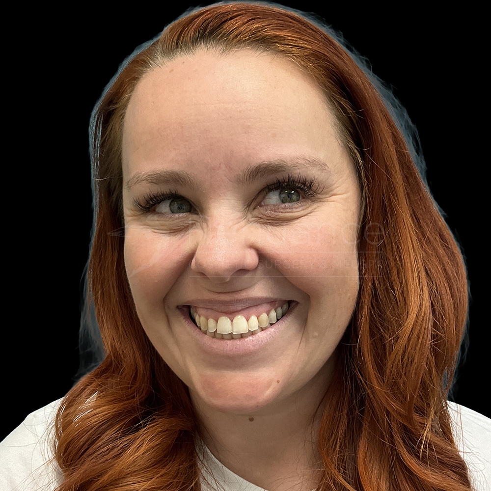 Case--4476 | After Chelsea Delaney, RN