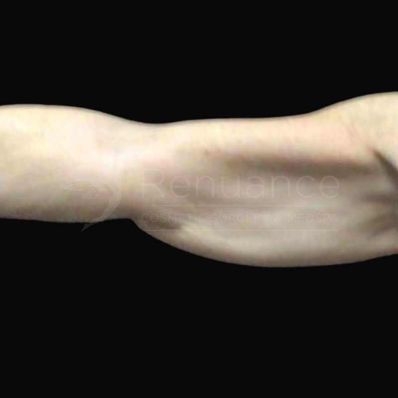 Case--3979H | Before Michael E. Hill, MD