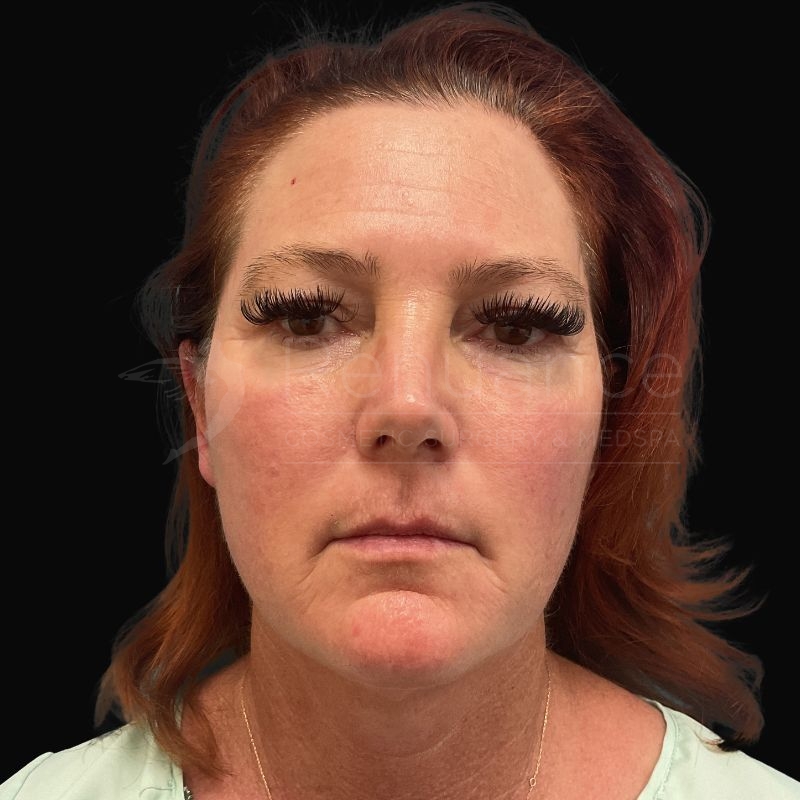 Case--8771 | After Chelsea Delaney, RN