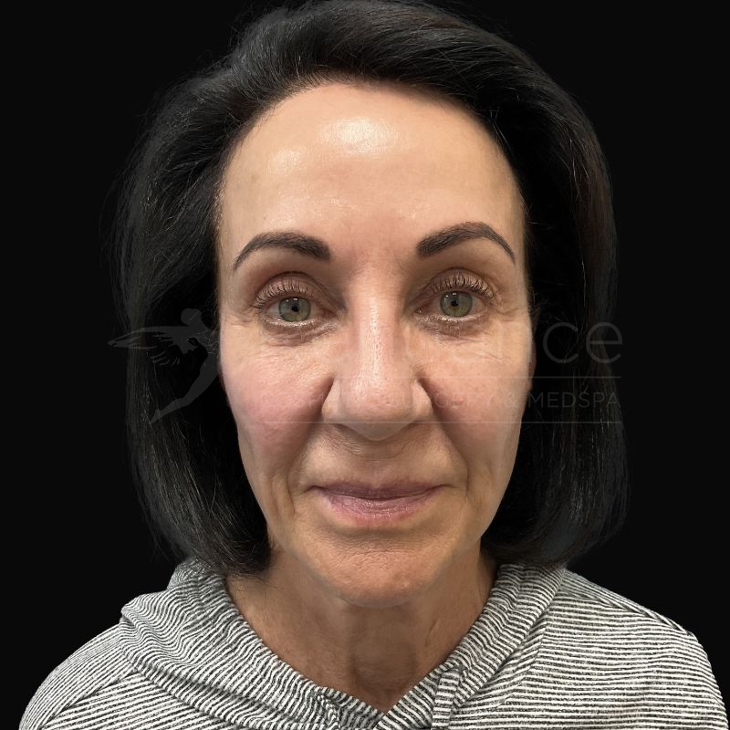 Case--1099 | Before Chelsea Delaney, RN