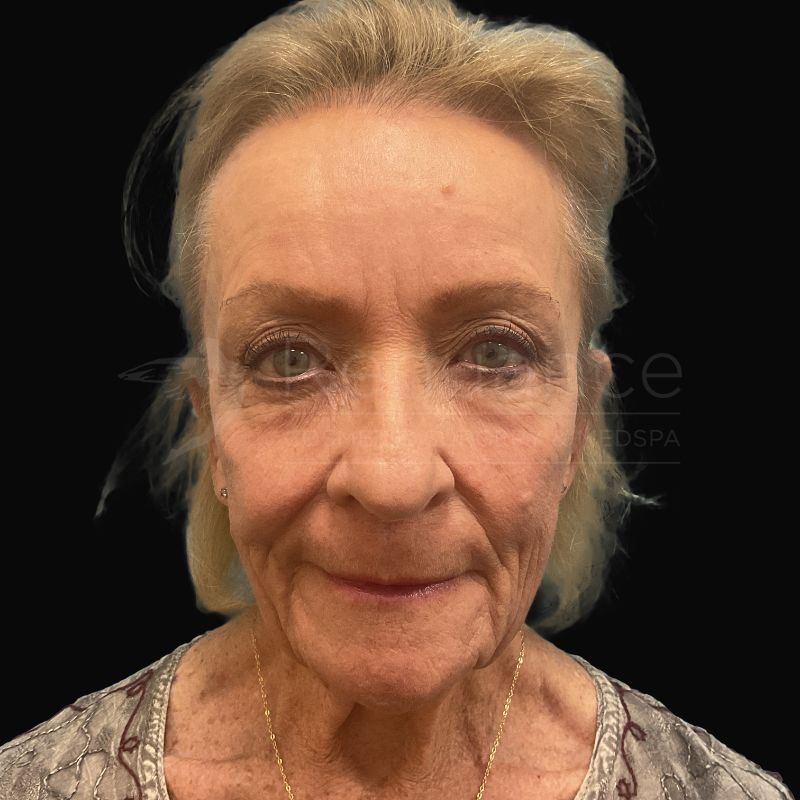 Case--9634 | After Chelsea Delaney, RN