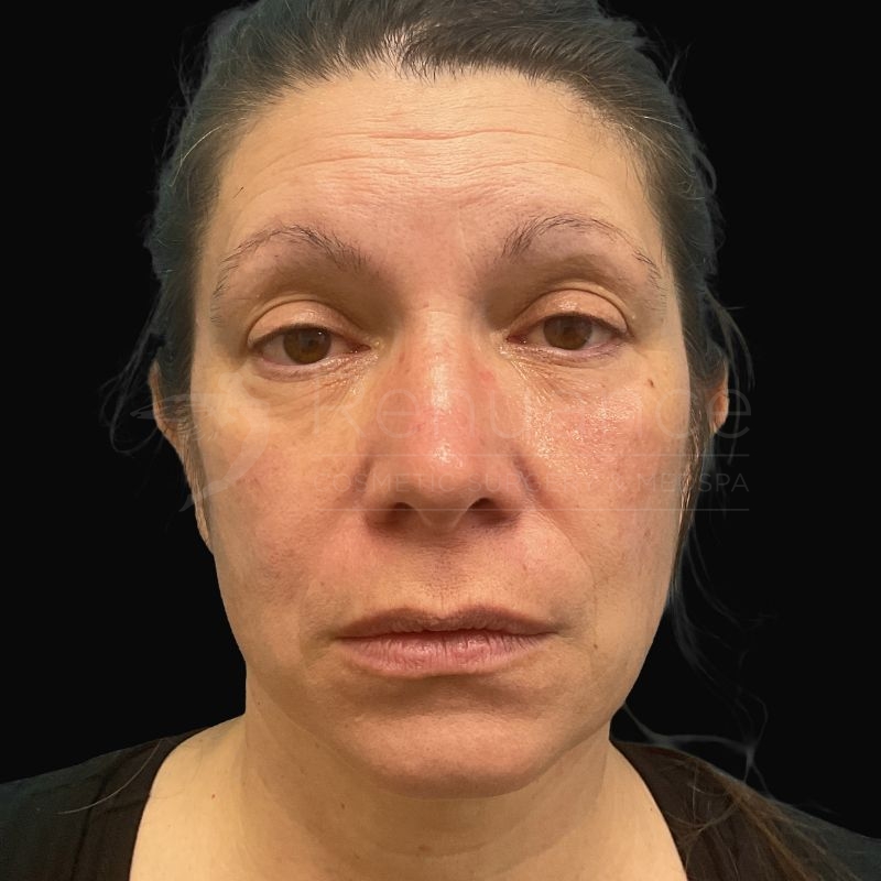 Case--9556 | After Chelsea Delaney, RN
