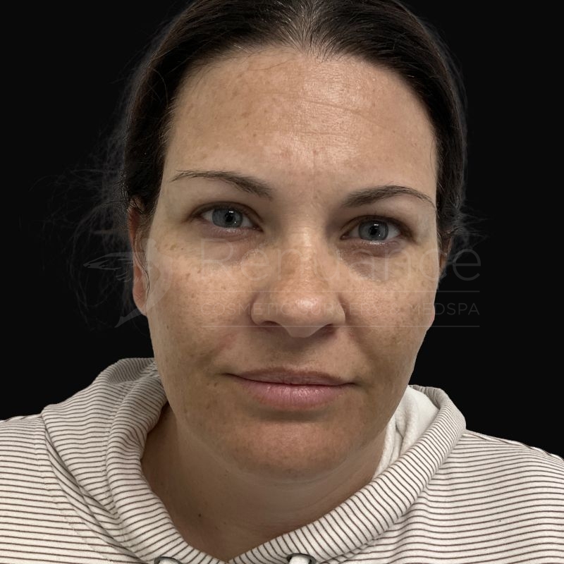 Case--5531 | Before Skin Care