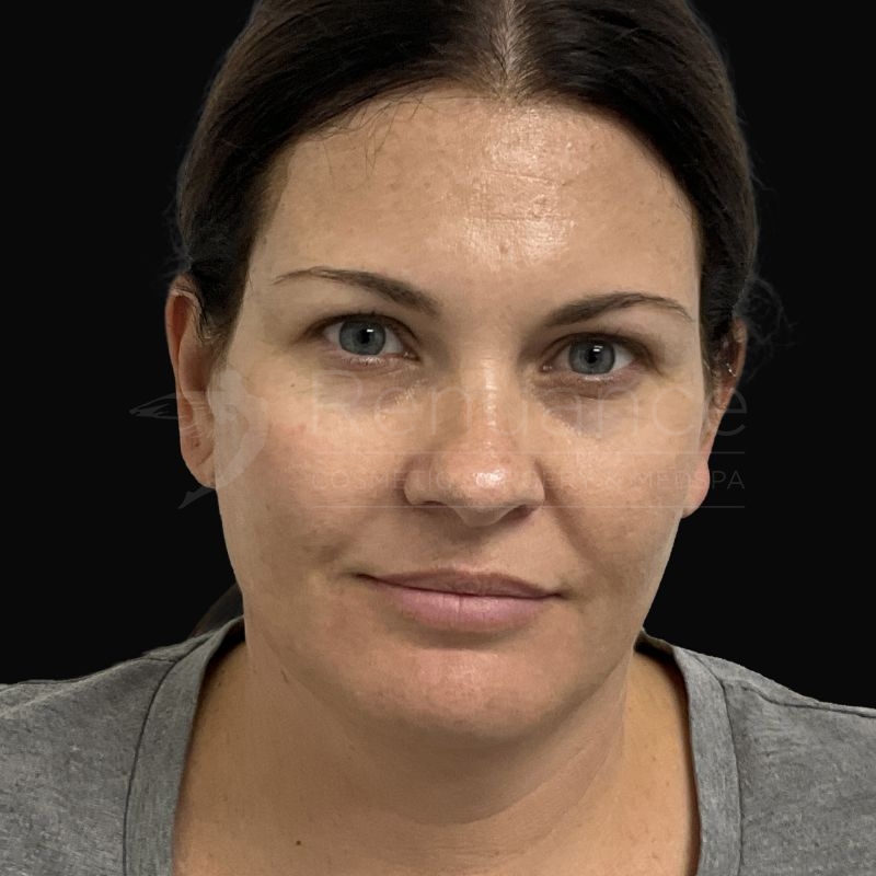 Case--5531 | After Skin Care