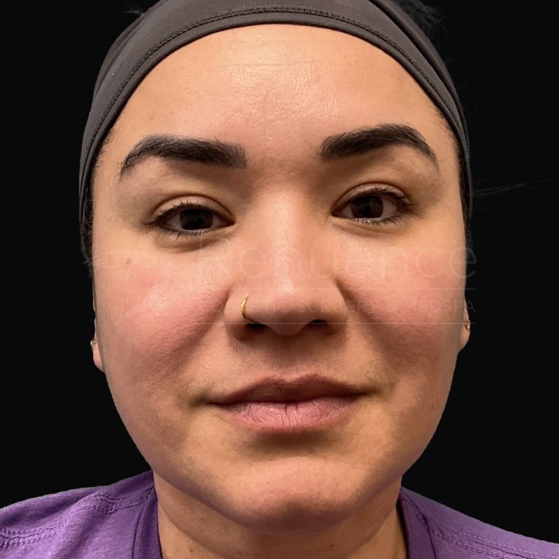 Case--8777 | Before Chelsea Delaney, RN