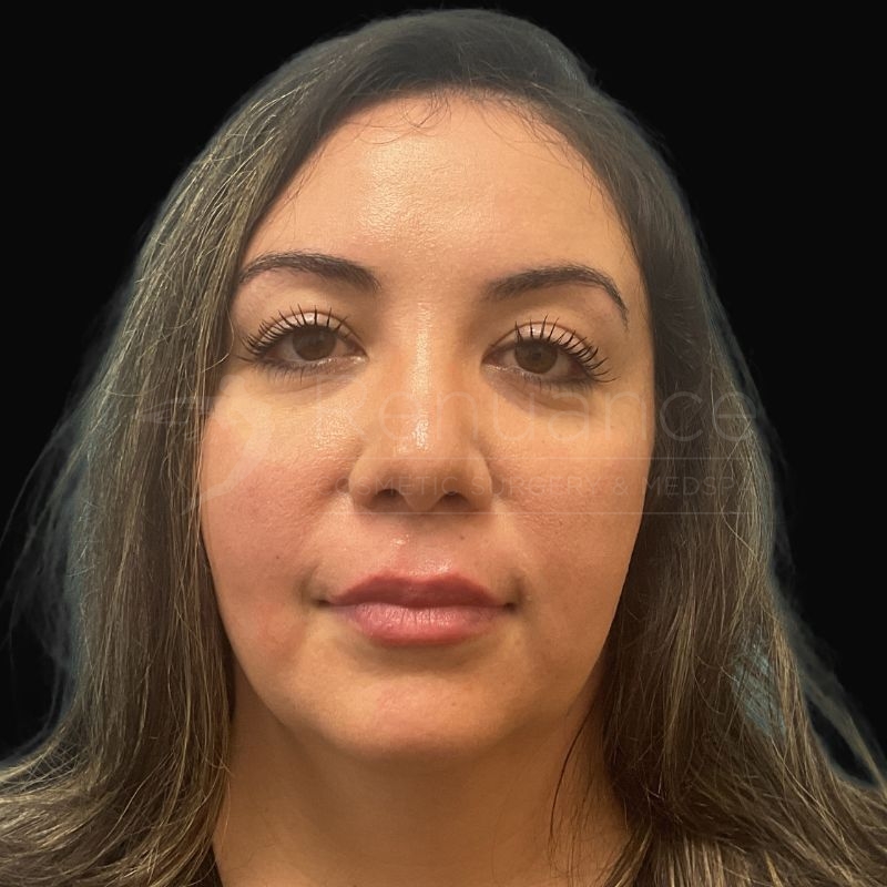 Case--9585 | After Chelsea Delaney, RN