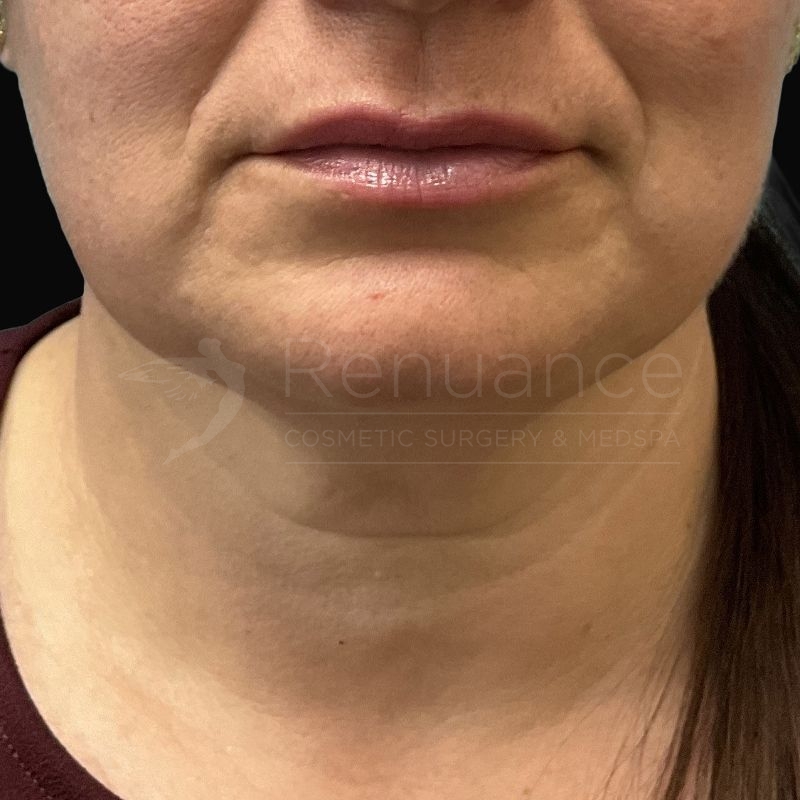 Case--1586 | Before Debbie Taurek, MD